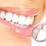 teeth cleaning